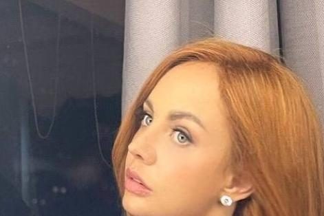 МакSим рассказала о самочувствии после рехаба: «Потеряла волосы» — Звезды