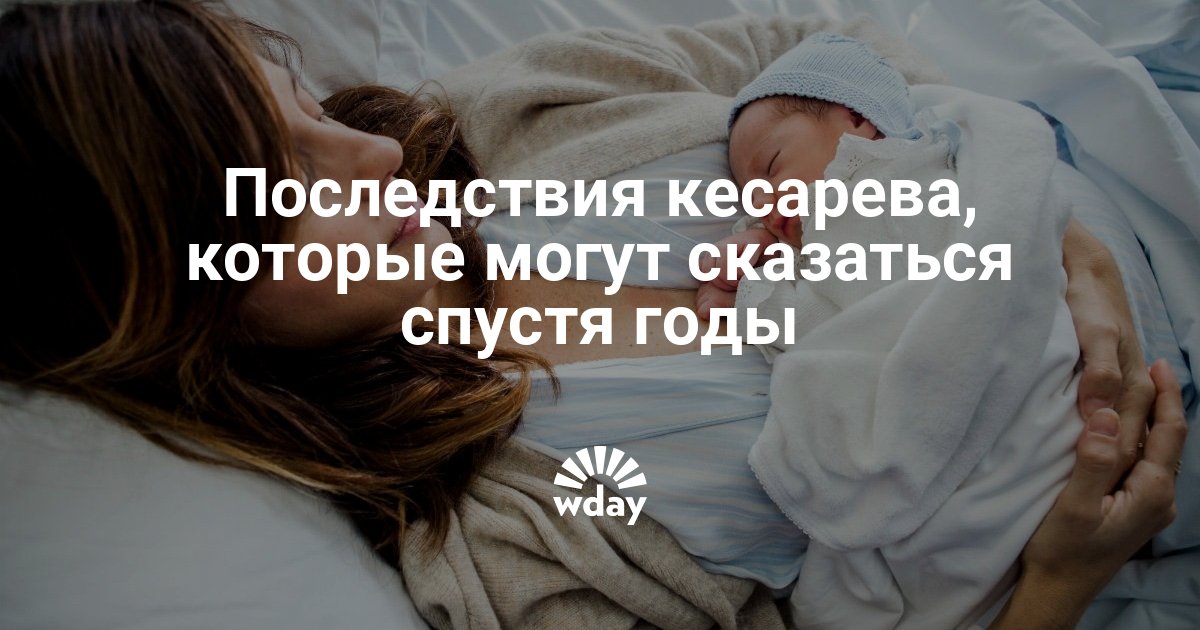 После кесарева сечения какие бывают осложнения — www.wday.ru