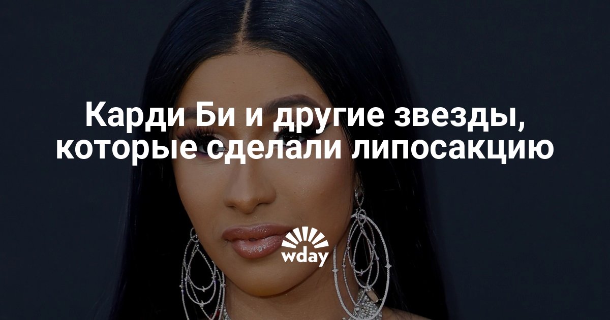 Карди Би и другие звезды, которые сделали липосакцию