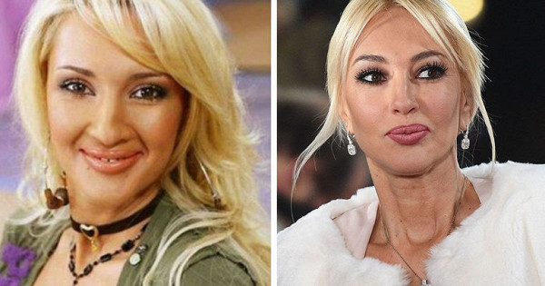 звезды, обожающие пластику — Рамблер/женский