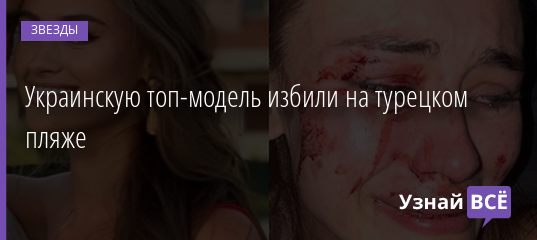 Украинскую топ-модель избили на турецком пляже 04.08.2020