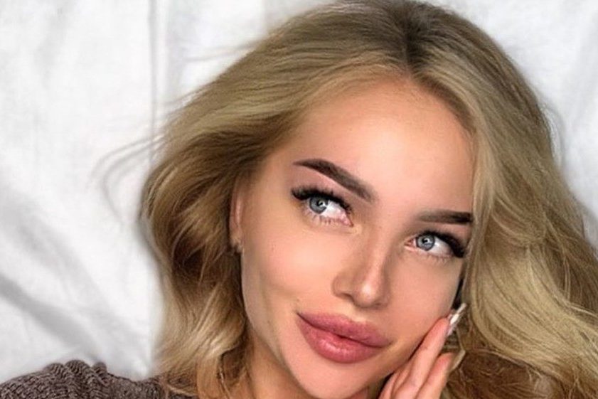 Звезда «ДОМа-2» Катя Скалон показала синяки после жестокого избиения