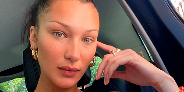 Самая красивая женщина в мире раскрыла детали своего серьезного заболевания 