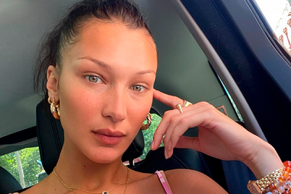 Самая красивая женщина в мире раскрыла детали своего серьезного заболевания 