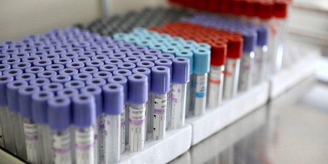 Ученые: вакцина от краснухи снижает шансы на тяжелую форму COVID-19 | Все о коронавирусе | Здоровье