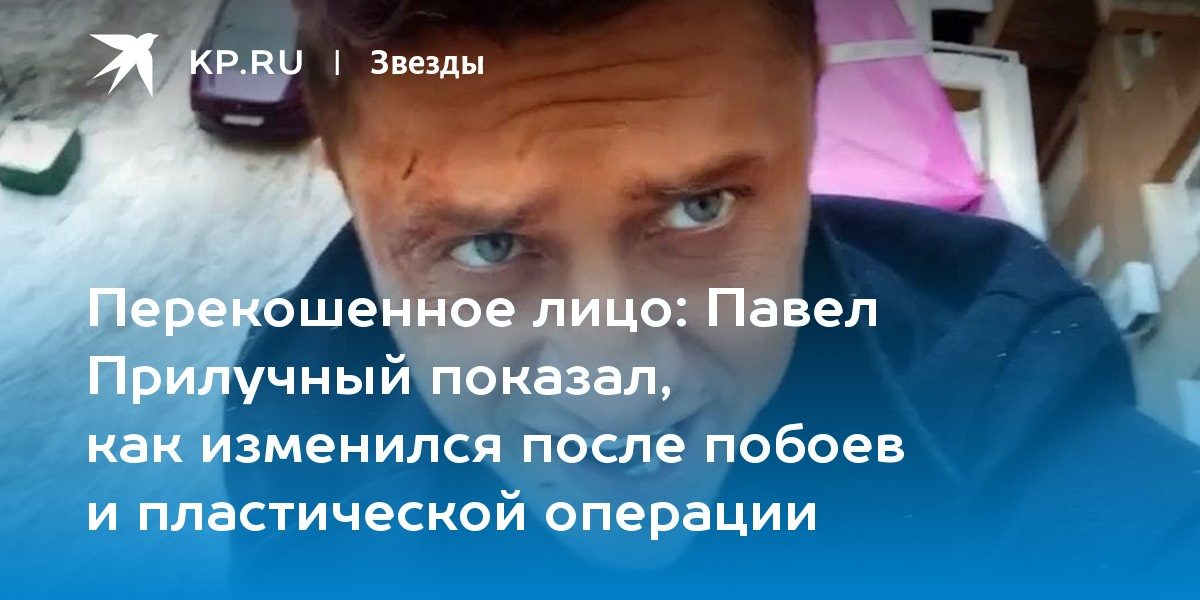 Павел Прилучный показал, как изменился после побоев и пластической операции