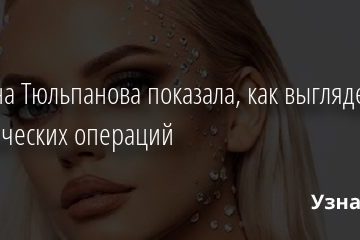 Милана Тюльпанова показала, как выглядела до пластических операций 31.01.2021