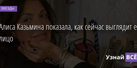 Алиса Казьмина показала, как сейчас выглядит ее лицо 03.02.2021