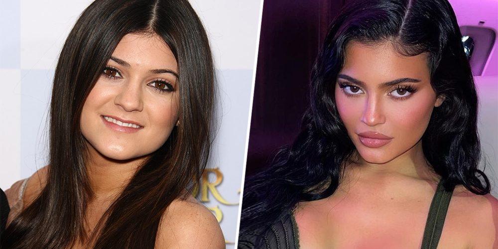 Дети звезд, которые сделали пластику до 18 лет