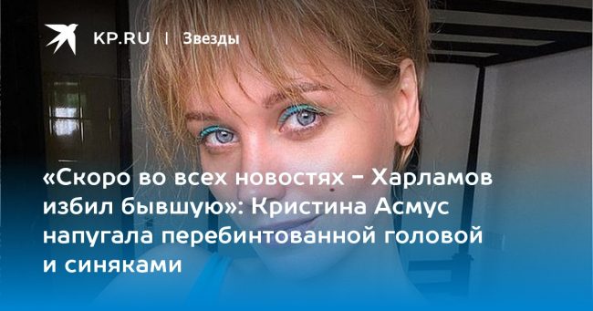 «Скоро во всех новостях — Харламов избил бывшую»: Кристина Асмус напугала перебинтованной головой и синяками