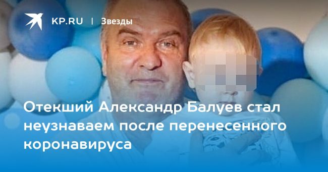 Отекший Александр Балуев стал неузнаваем после перенесенного коронавируса