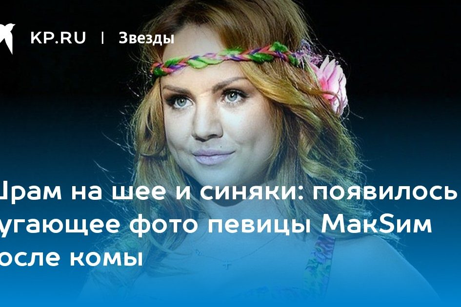появилось пугающее фото певицы МакSим после комы