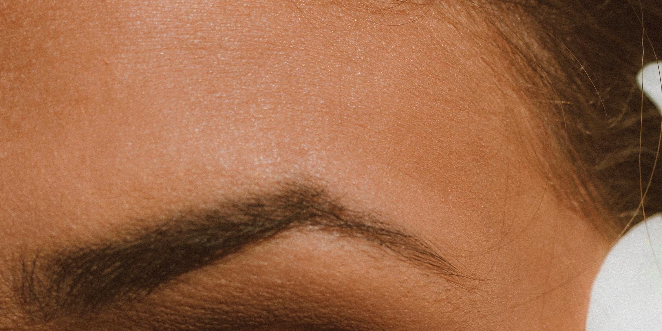 Какие проблемы может решить блефаропластика — Красота