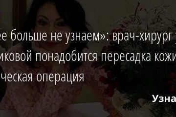 «Мы ее больше не узнаем»: врач-хирург уверен, Хлебниковой понадобится пересадка кожи и пластическая операция 19.11.2021 | Звезды, шоу-бизнес