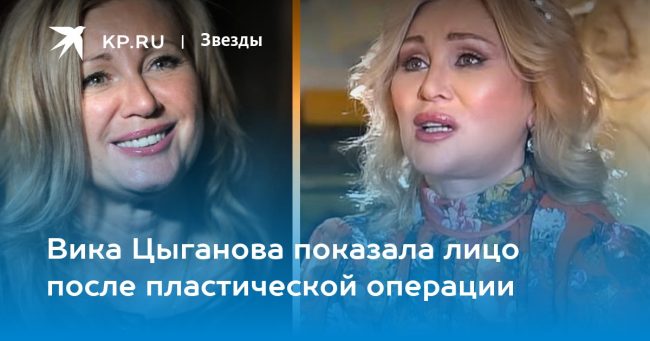 Вика Цыганова показала лицо после пластической операции