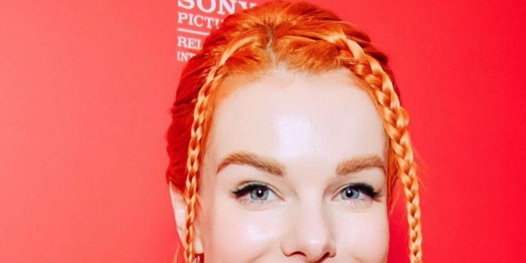 Старшенбаум — о вмешательствах в свою внешность: «Врач мне переколол носогубку» — Звезды