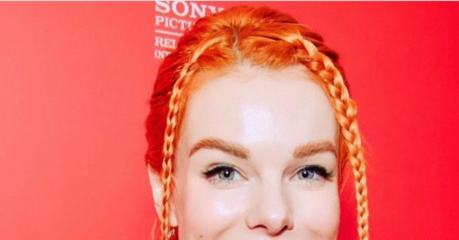 Старшенбаум — о вмешательствах в свою внешность: «Врач мне переколол носогубку» — Звезды