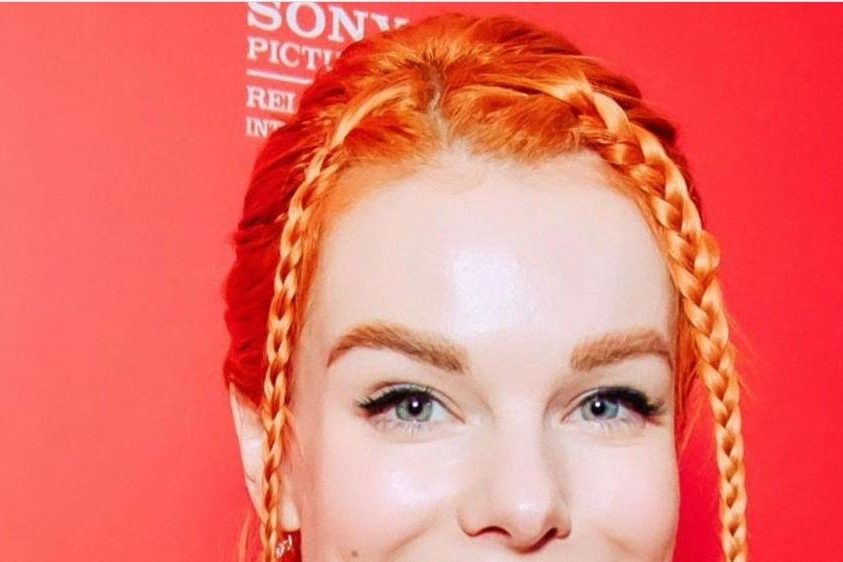 Старшенбаум — о вмешательствах в свою внешность: «Врач мне переколол носогубку» — Звезды