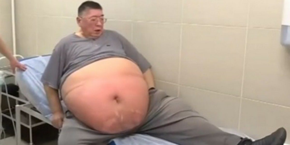 «Поскорее умереть и не мучиться»: мужчина располнел до 220 килограммов и не делает операцию