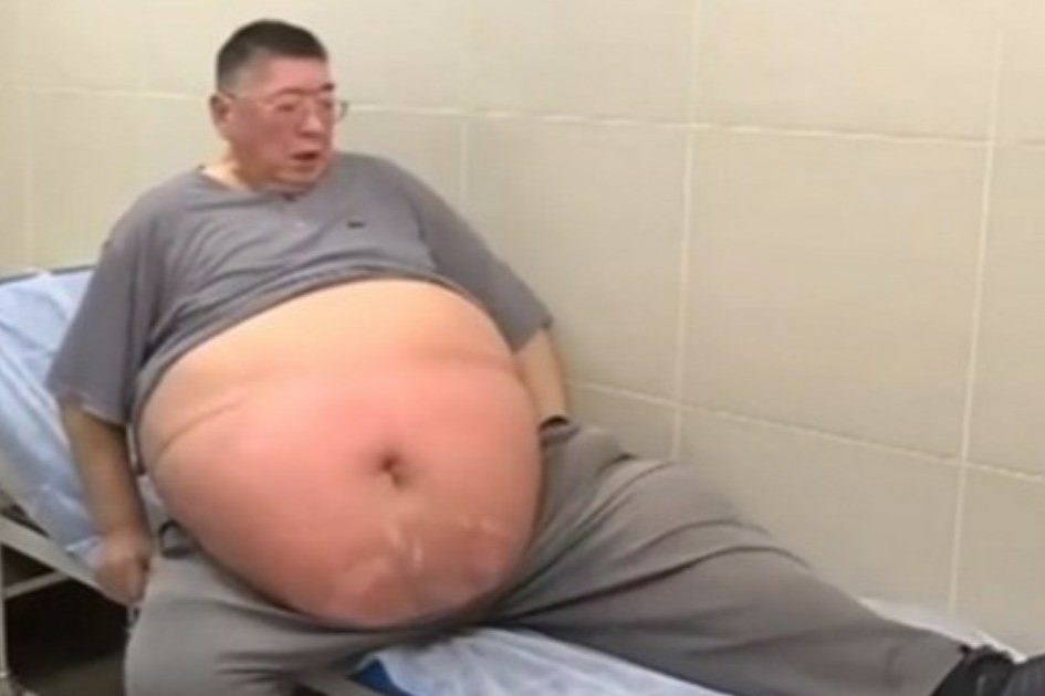 «Поскорее умереть и не мучиться»: мужчина располнел до 220 килограммов и не делает операцию