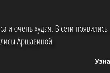 Без носа и очень худая. В сети появились новые фото Алисы Аршавиной 15.05.2022 | Звезды, шоу-бизнес