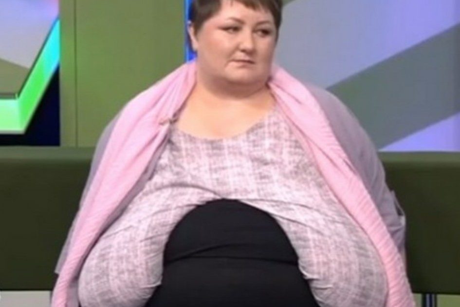 «Позвоночник треснет, или задохнусь»: женщина с 17 размером груди умирает из-за лишнего веса