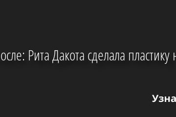 До и после: Рита Дакота сделала пластику носа 09.06.2022 | Звезды, шоу-бизнес