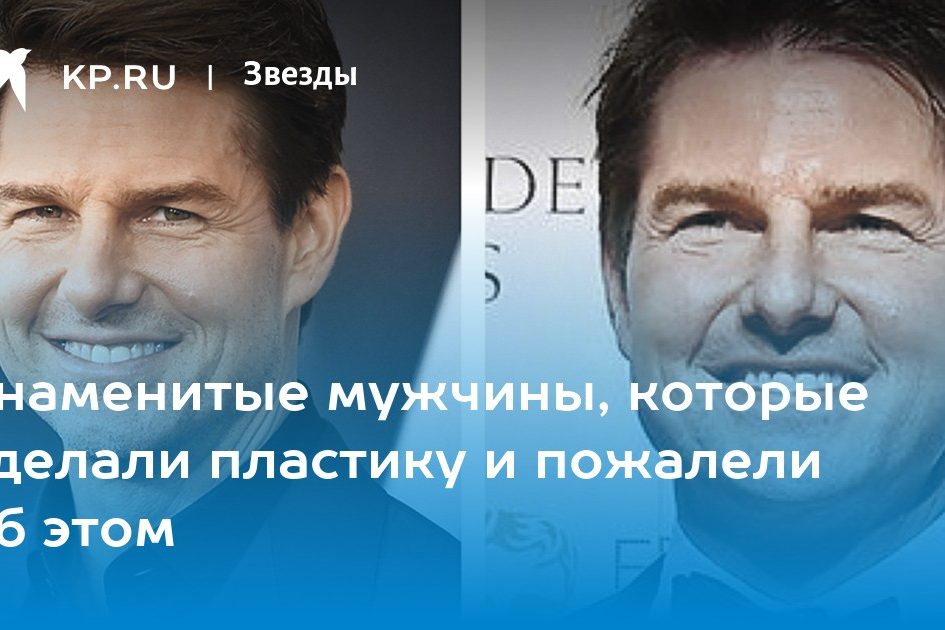 Знаменитые мужчины, которые сделали пластику и пожалели об этом