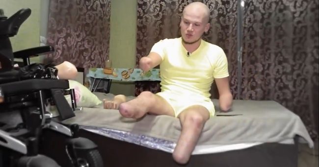 «У меня ручек и ножек уже не будет»: попавший под поезд блогер Кошкин о том, как выживает в одиночку