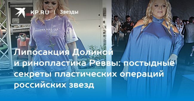 Липосакция Долиной и ринопластика Реввы: постыдные секреты пластических операций российских звезд