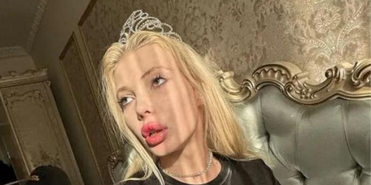 Девушка Паши Техника чудом выжила после падения с многоэтажки и рассказала, что случилось