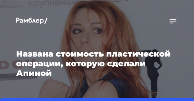 Названа стоимость пластической операции, которую сделали Апиной
