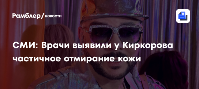 СМИ: Врачи выявили у Киркорова частичное отмирание кожи