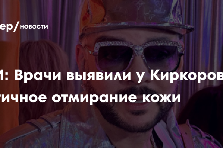 СМИ: Врачи выявили у Киркорова частичное отмирание кожи