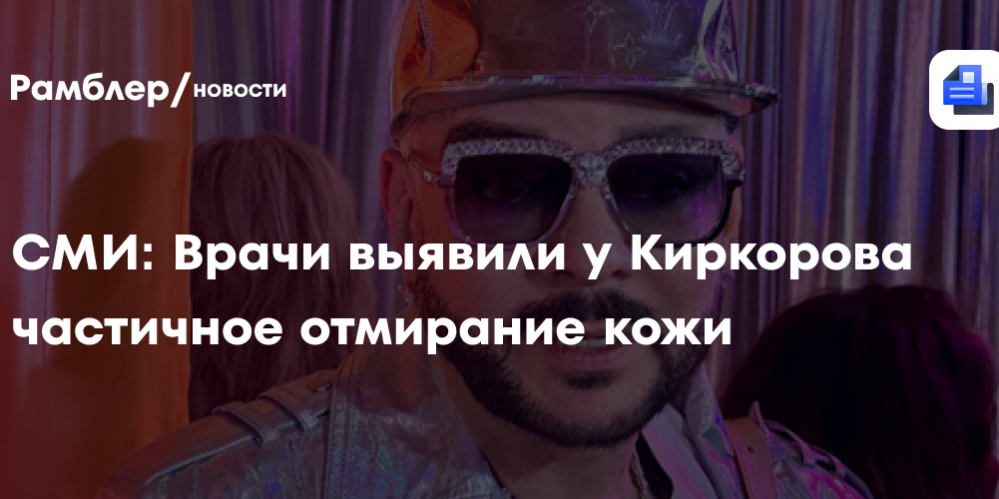 СМИ: Врачи выявили у Киркорова частичное отмирание кожи