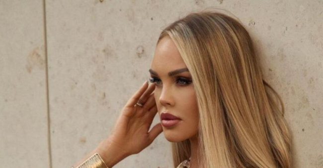 Мария Погребняк напугала фанатов, показав жуткие гематомы на коленях