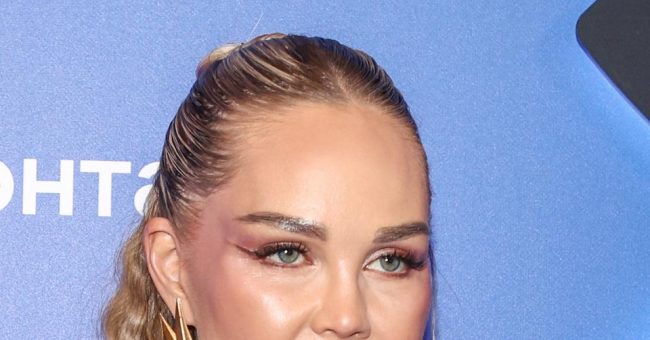 звезда Comedy Woman Кравченко получила травму на съемках