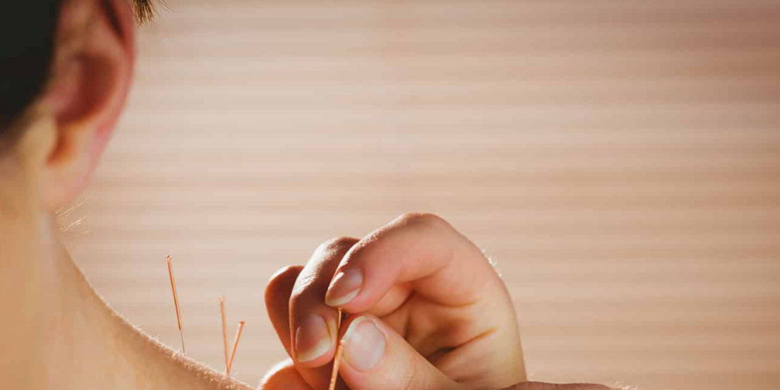 Помогает ли иглоукалывание