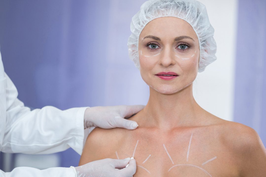 Пять случаев, когда перед пластикой нужна консультация психолога