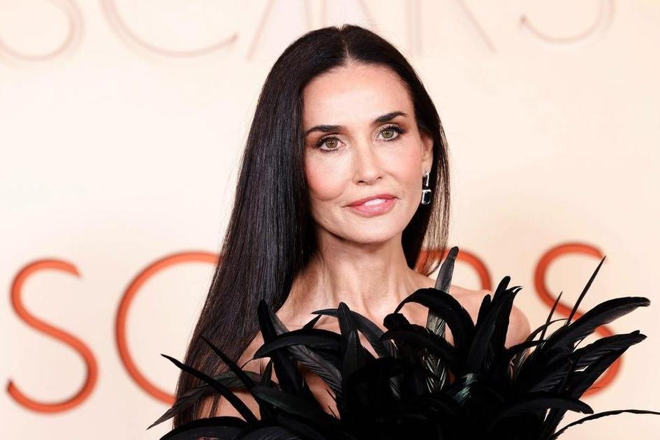 Эмма Стоун перестаралась с пластикой, Тимоти Шаламе высмеяли за усики: